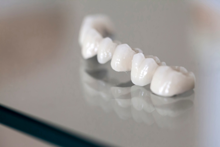 Zirconium Porcelain Tooth plate in Dentist Store